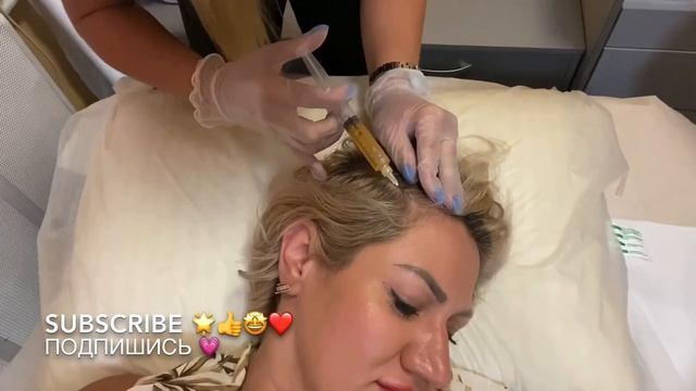 PLATELET-RICH PLASMA (PRP) INJECTION THERAPY FOR HAIR | HEALTHY HAIR | ПЛАЗМОТЕРАПИЯ ВОЛОС смотреть онлайн