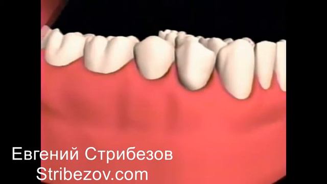 Имплантация в Санкт-петербурге - цены смотреть онлайн