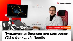 Пункционная биопсия под контролем УЗИ с функцией iNeedle