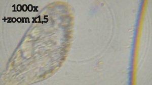 Инфузория стилонихия под микроскопом