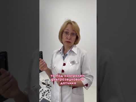 Уплотнения в коже после филлеров. Что делать? Рассказывает врач Яковлева Ольга Михайловна.