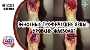 Венозные трофические язвы: уровень флеболог