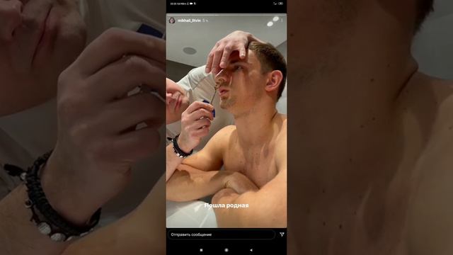 Литвин сломал НОС 👃 смотреть онлайн