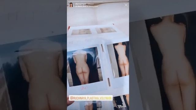 Диана Пегас в Центре Ручная Пластика Юрия Андреевича Волынкина  Звездные Сторис / ручная пластика