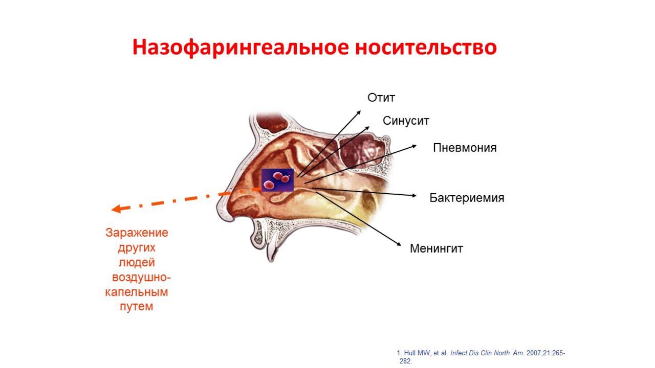 Профилактика пневмококковой инфекции