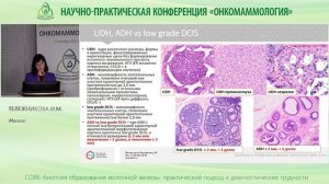 CORE биопсия образований молочной железы   практический подход и диагностические трудности