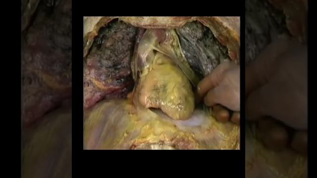 Роланда сердце смотреть онлайн