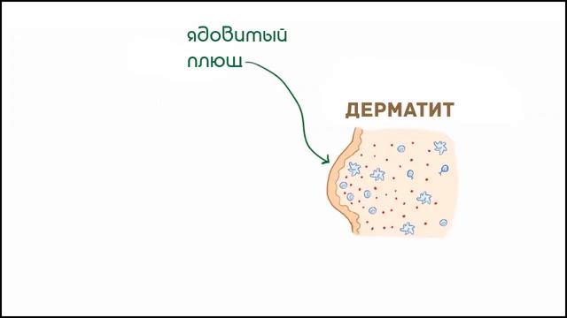Гиперчувствительность 4 типа - механизм и примеры реализации