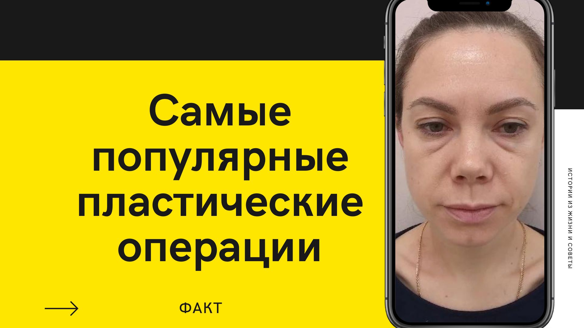 Самые популярные пластические операции?