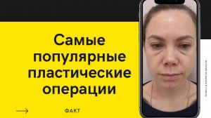 Самые популярные пластические операции?