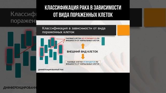 Классификация рака в зависимости от вида пораженных клеток #рак #медицина #классификациярака