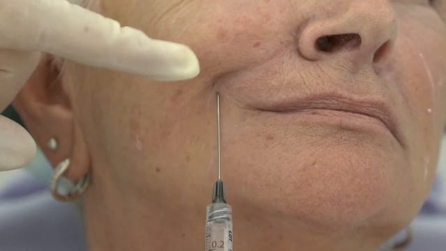 Medicadue Tutorial 1 | Prof.Nicola Zerbinati e Dott.ssa Renata Migliardi Medicadue Tutorial 1 смотреть онлайн