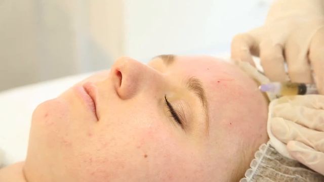 Плазмолифтинг смотреть онлайн