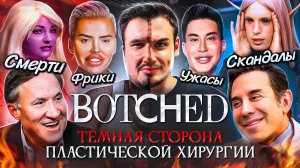 Шоу "BOTCHED" — тёмная сторона пластической хирургии | Грязь, фрики, скандалы и смерти участников