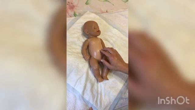 Упражнения для детей с пупочной грыжей