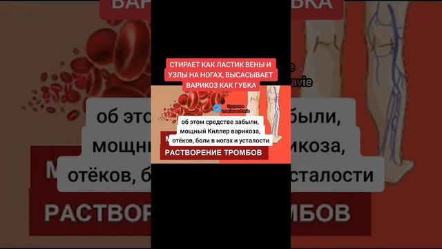 стирает как ластик вены и узлы на ногах #здоровье #народнаямедицина #полезныесоветы #зож