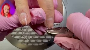 КАК НАРАСТИТЬ НА ОЖОГ? НОГТИ ПОСЛЕ ОЖОГА ЧЕМ МОЖНО ПОКРЫВАТЬ? Дип система. Титановые ногти