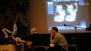 Мастер-класс на аппарате Mindray DC-8. Часть I