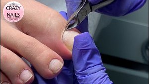 ЭСТЕТИЧЕСКИЙ ПЕДИКЮР. Обработка стоп. Голубая лагуна на ногтях.