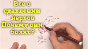 Как сдавливаются корешки и нервы?