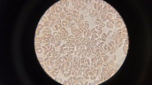 Кровь после кофе. Это надо видеть!