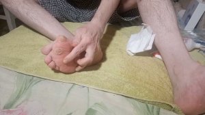 Большие мозоли и натоптыши единственный способ удаления