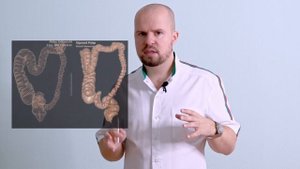 Виртуальная колоноскопия. Что это и как проводится? // ПРОКТОЛОГ СОТНИКОВ
