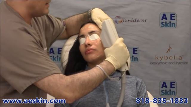 Forever Young BBL IPL Photofacial Demonstration 21 - A E Skin - Encino, CA - 818-835-1833 смотреть онлайн