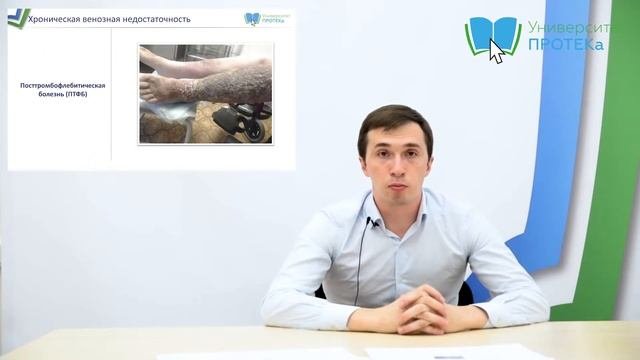 Хроническая венозная недостаточность
