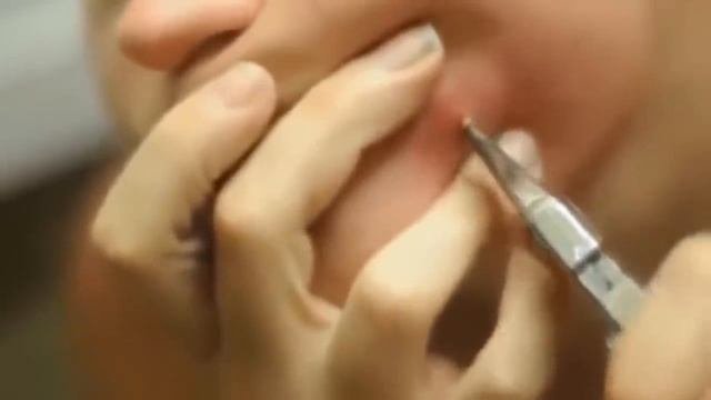 ШООК БОЛЬШОЙ ЧИРЕЙ/БОЛЬШОЙ ЧИРЯК/БОЛЬШОЙ ПРЫЩ/БОЛЬШОЙ ГНОЙНИК\МНОГО ГНОЯ