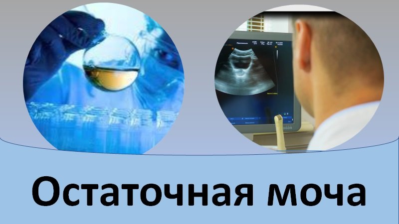 Причины слабой струи мочи. Остаточная моча. Остаточная моча у мужчин.