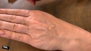 Как простой советский клей, вдруг стал медицинским