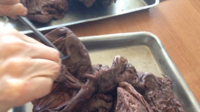 Анатомия толстой кишки (intestinum crassum) смотреть онлайн