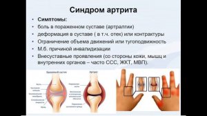 9:50 Анатомо-физиологические особенности костно-мышечной системы у детей