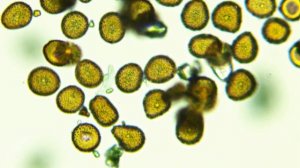 Базидиальный гриб Puccinia helianthi Schw (соскоб ржавчины с листа подсолнечника)