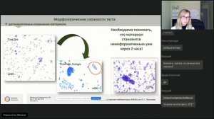 Клиническая значимость и особенности пробоподготовки перитонеальных смывов