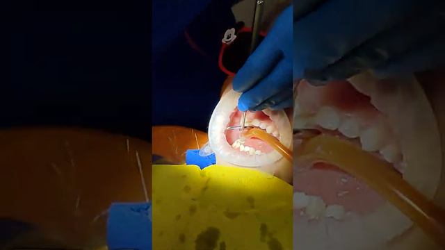 правильный выбор #стоматолог и #ребенок ничего не #боится .#shortsvideo #short #kidsvideo #smile смотреть онлайн
