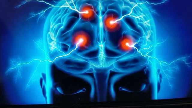 SEIZURES - What are seizures ? Facts, Causes, Pathophysiology & causes - Neurology - Seizure series смотреть онлайн