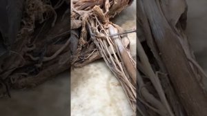 Анатомия - шейное, плечевое сплетение