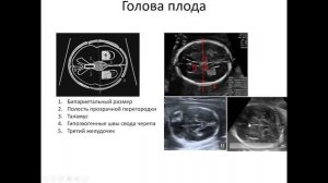 УЗИ плода во 2-3 триместрах. Часть 1. 2022 05 13 13 14 07