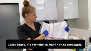 Подготовка стола для приему