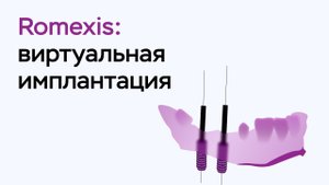 Возможности программы Romexis Viewer: виртуальная имплантация