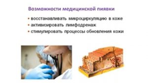 Доклад главного врача Центра медицинской пиявки "Юнитек" на тему: Гирудотерапия в косметологии.