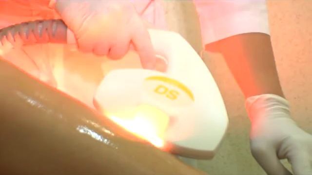 Салон "Cherry" - вся правда про элос эпиляцию смотреть онлайн