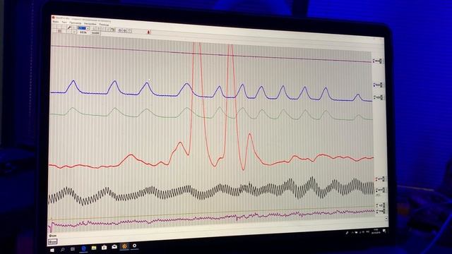 Осознанность (МАЙНДФУЛНЕСС) в действии. Суть невовлечения. смотреть онлайн