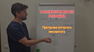 Протрузия сетчатого имплантата. Осложнения после операции