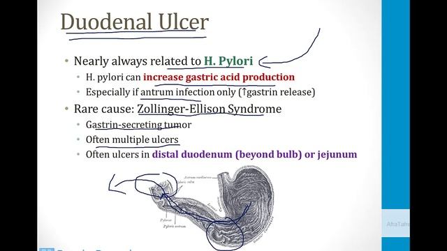 Гастроэнтерология USMLE - 3. Клиническая Гастроэнтерология - 8.Желудочные расстройства