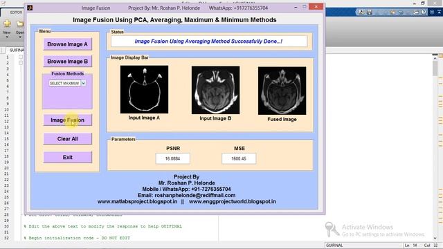 Image Fusion Using PCA on MRI and CT Image Matlab Project with Source Code
