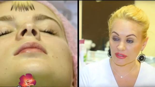 Летние пилинги. Контурная пластика. Студия красоты "Estetik" смотреть онлайн