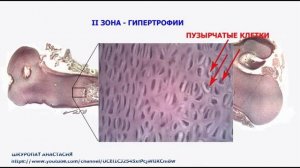 Гистологический препарат "Развитие кости на месте хряща"